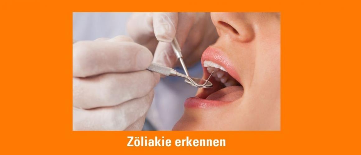 Frau mit offenen Mund und Hände des Zahnarzts, der die Zähne überprüft